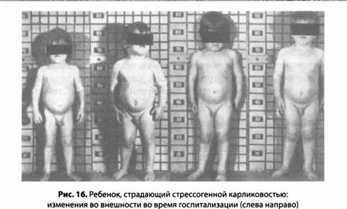 Психология стресса Психология стресса