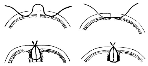 Век хирургов Век хирургов
