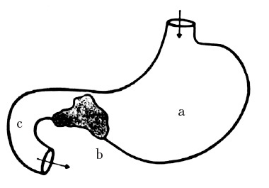 Век хирургов Век хирургов