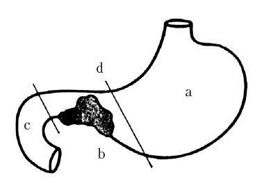 Век хирургов Век хирургов