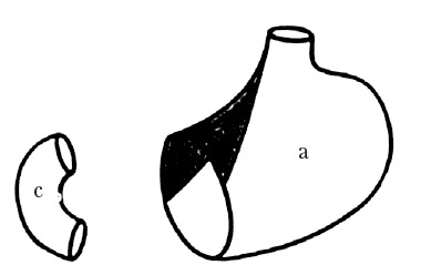 Век хирургов Век хирургов