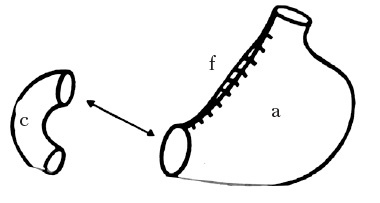 Век хирургов Век хирургов