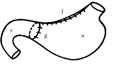 Век хирургов Век хирургов