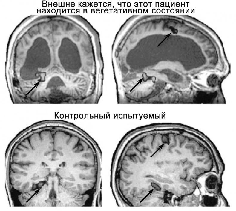 Сознание и мозг. Как мозг кодирует мысли Сознание и мозг. Как мозг кодирует мысли