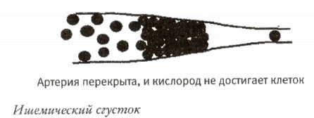 Мой инсульт был мне наукой. История собственной болезни, рассказанная нейробиологом Мой инсульт был мне наукой. История собственной болезни, рассказанная нейробиологом