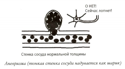 Мой инсульт был мне наукой. История собственной болезни, рассказанная нейробиологом Мой инсульт был мне наукой. История собственной болезни, рассказанная нейробиологом