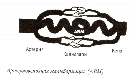 Мой инсульт был мне наукой. История собственной болезни, рассказанная нейробиологом Мой инсульт был мне наукой. История собственной болезни, рассказанная нейробиологом