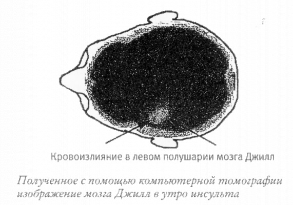 Мой инсульт был мне наукой. История собственной болезни, рассказанная нейробиологом Мой инсульт был мне наукой. История собственной болезни, рассказанная нейробиологом