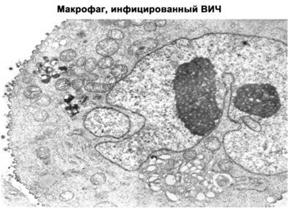 Имя ему СПИД. Четвертый всадник Апокалипсиса Имя ему СПИД. Четвертый всадник Апокалипсиса