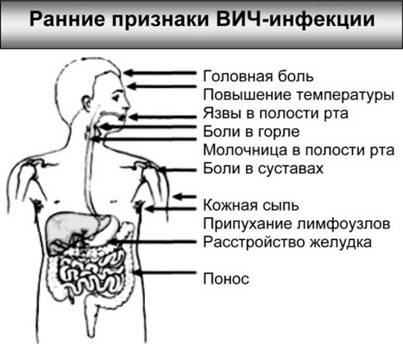 Имя ему СПИД. Четвертый всадник Апокалипсиса Имя ему СПИД. Четвертый всадник Апокалипсиса