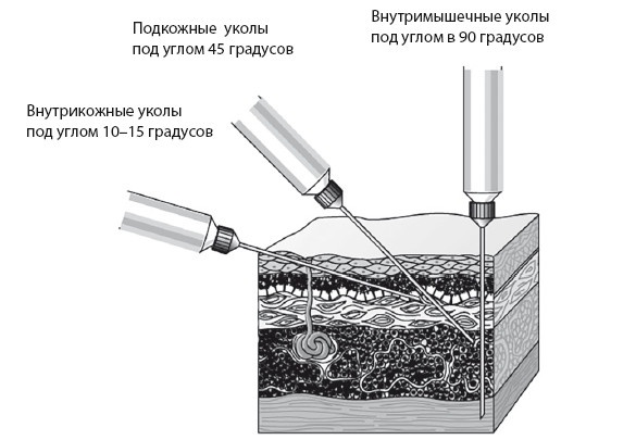 Уколы, капельницы, перевязки и другие медицинские процедуры и манипуляции Уколы, капельницы, перевязки и другие медицинские процедуры и манипуляции