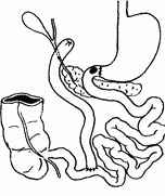 Этюды желудочной хирургии Этюды желудочной хирургии