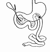 Этюды желудочной хирургии Этюды желудочной хирургии
