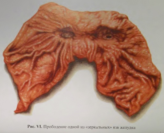 Этюды желудочной хирургии Этюды желудочной хирургии
