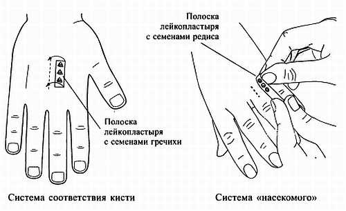 Сам себе Су Джок доктор Сам себе Су Джок доктор