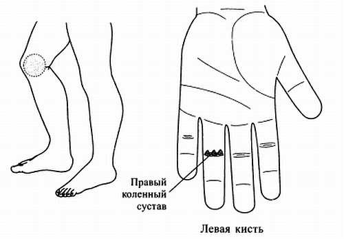 Сам себе Су Джок доктор Сам себе Су Джок доктор