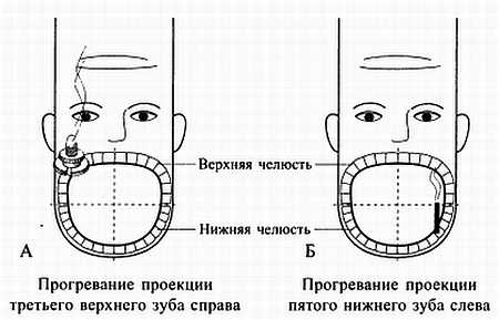 Сам себе Су Джок доктор Сам себе Су Джок доктор