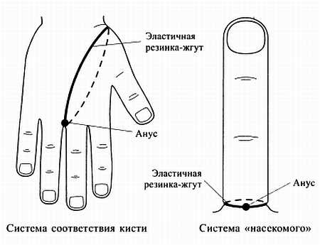 Сам себе Су Джок доктор Сам себе Су Джок доктор