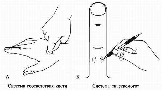 Сам себе Су Джок доктор Сам себе Су Джок доктор