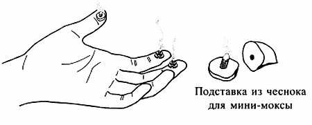 Сам себе Су Джок доктор Сам себе Су Джок доктор