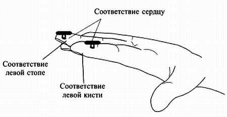 Сам себе Су Джок доктор Сам себе Су Джок доктор