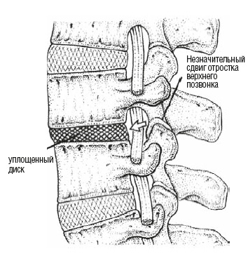 Настольная книга для тех, у кого болит спина Настольная книга для тех, у кого болит спина