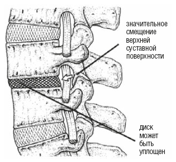 Настольная книга для тех, у кого болит спина Настольная книга для тех, у кого болит спина