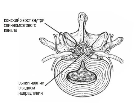 Настольная книга для тех, у кого болит спина Настольная книга для тех, у кого болит спина