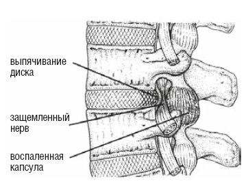 Настольная книга для тех, у кого болит спина Настольная книга для тех, у кого болит спина