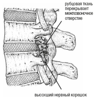 Настольная книга для тех, у кого болит спина Настольная книга для тех, у кого болит спина