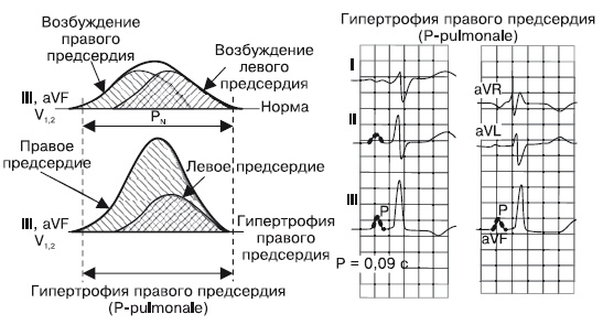 Что показывает кардиограмма Что показывает кардиограмма