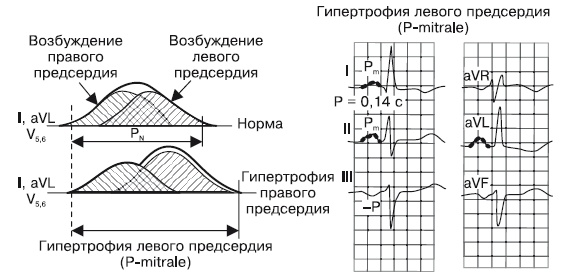 Что показывает кардиограмма Что показывает кардиограмма