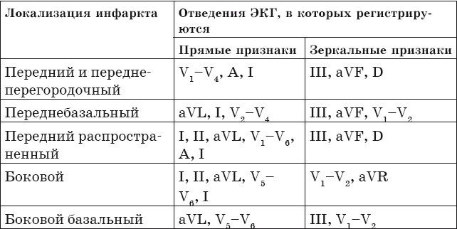 Что показывает кардиограмма Что показывает кардиограмма
