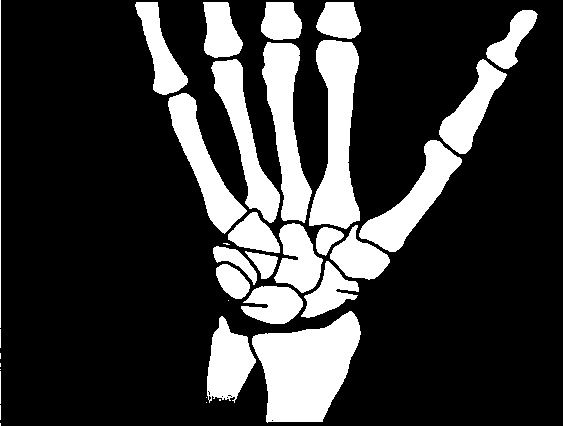 Осторожно, спорт! О вреде бега, фитнеса и других физических нагрузок Осторожно, спорт! О вреде бега, фитнеса и других физических нагрузок