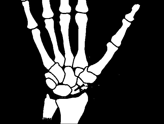 Осторожно, спорт! О вреде бега, фитнеса и других физических нагрузок Осторожно, спорт! О вреде бега, фитнеса и других физических нагрузок