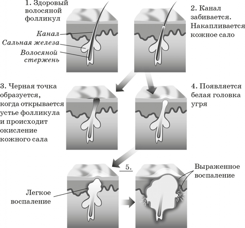 Как обмануть возраст Как обмануть возраст