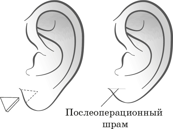 Как обмануть возраст Как обмануть возраст