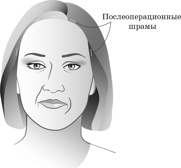 Как обмануть возраст Как обмануть возраст