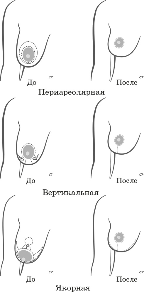 Как обмануть возраст Как обмануть возраст