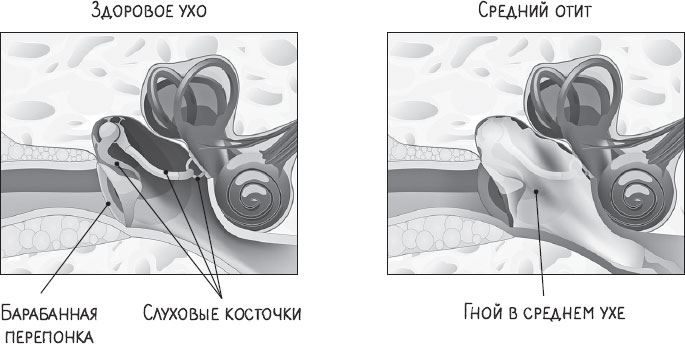 В лабиринтах уха, горла и носа. Скрытые механизмы работы, неочевидные взаимосвязи и полезные знания, которые помогут «дотянуть» до визита к врачу В лабиринтах уха, горла и носа. Скрытые механизмы работы, неочевидные взаимосвязи и полезные знания, которые помогут «дотянуть» до визита к врачу